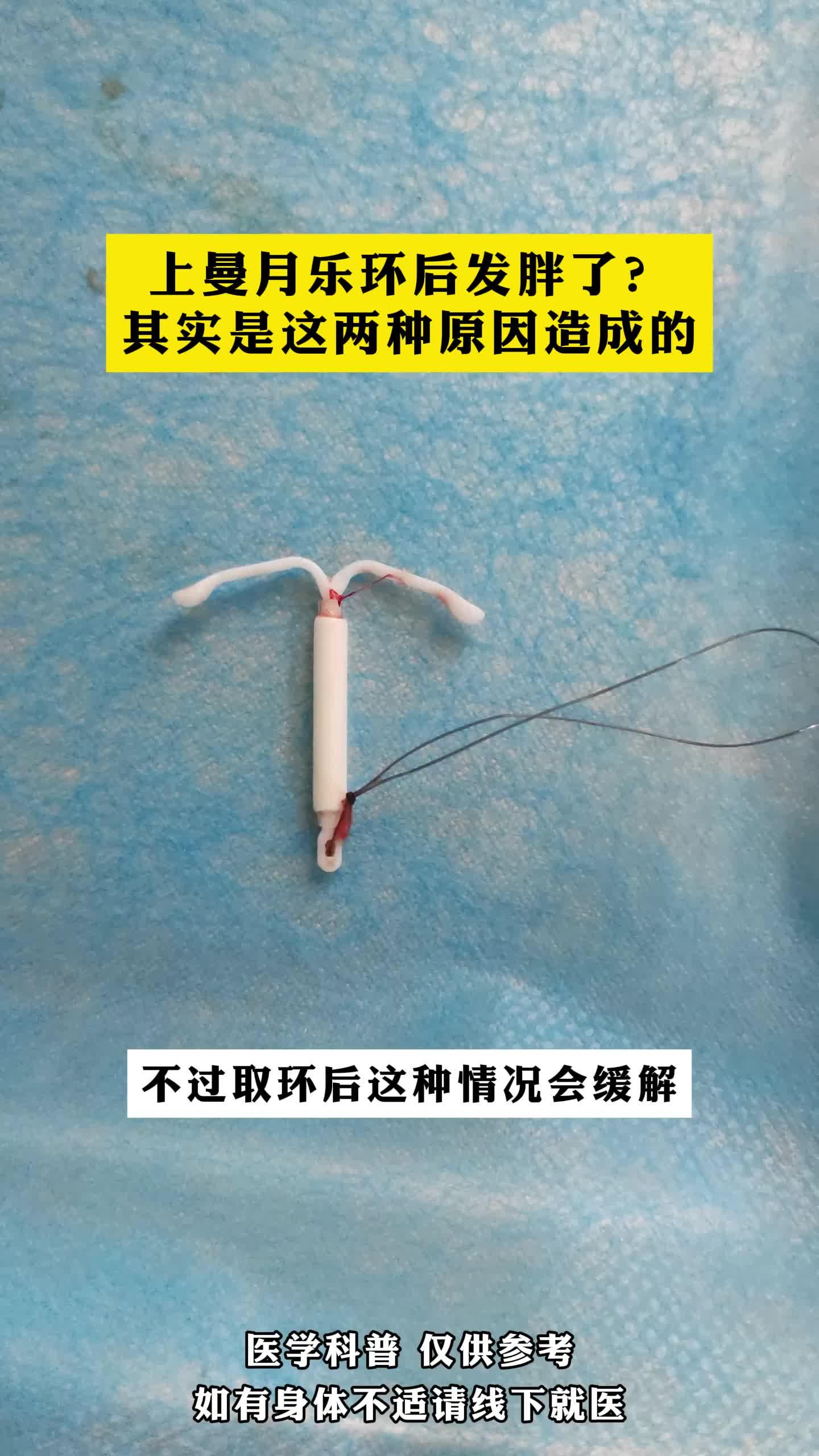 上曼月乐环后发胖了其实是这两种原因造成的