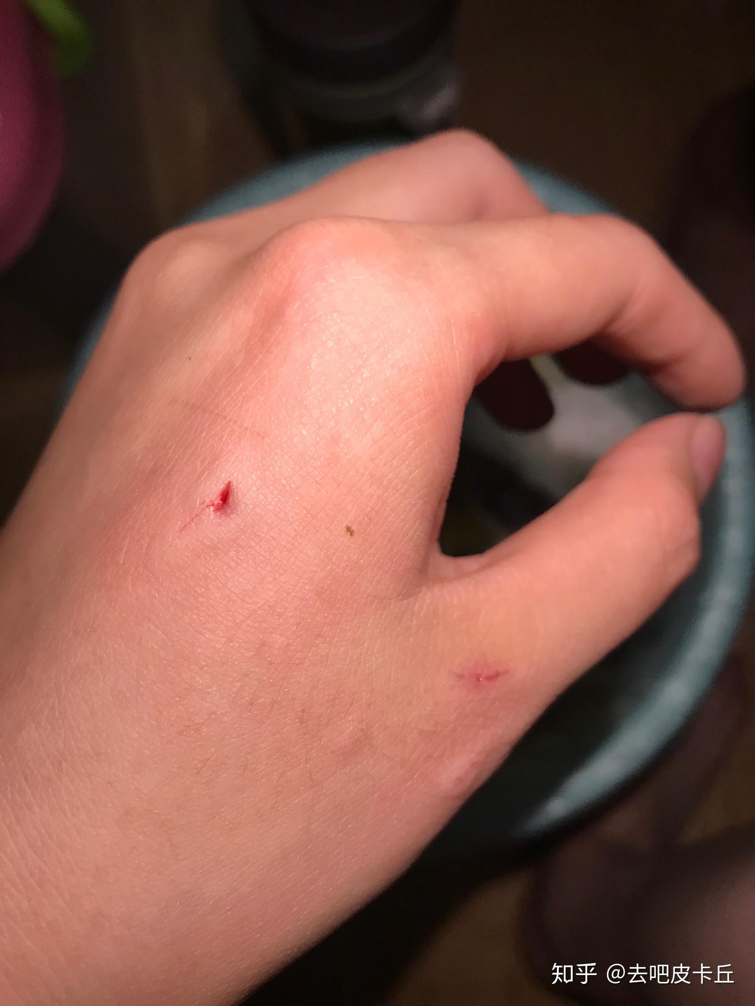 被猫咬了怎么办? - 知乎