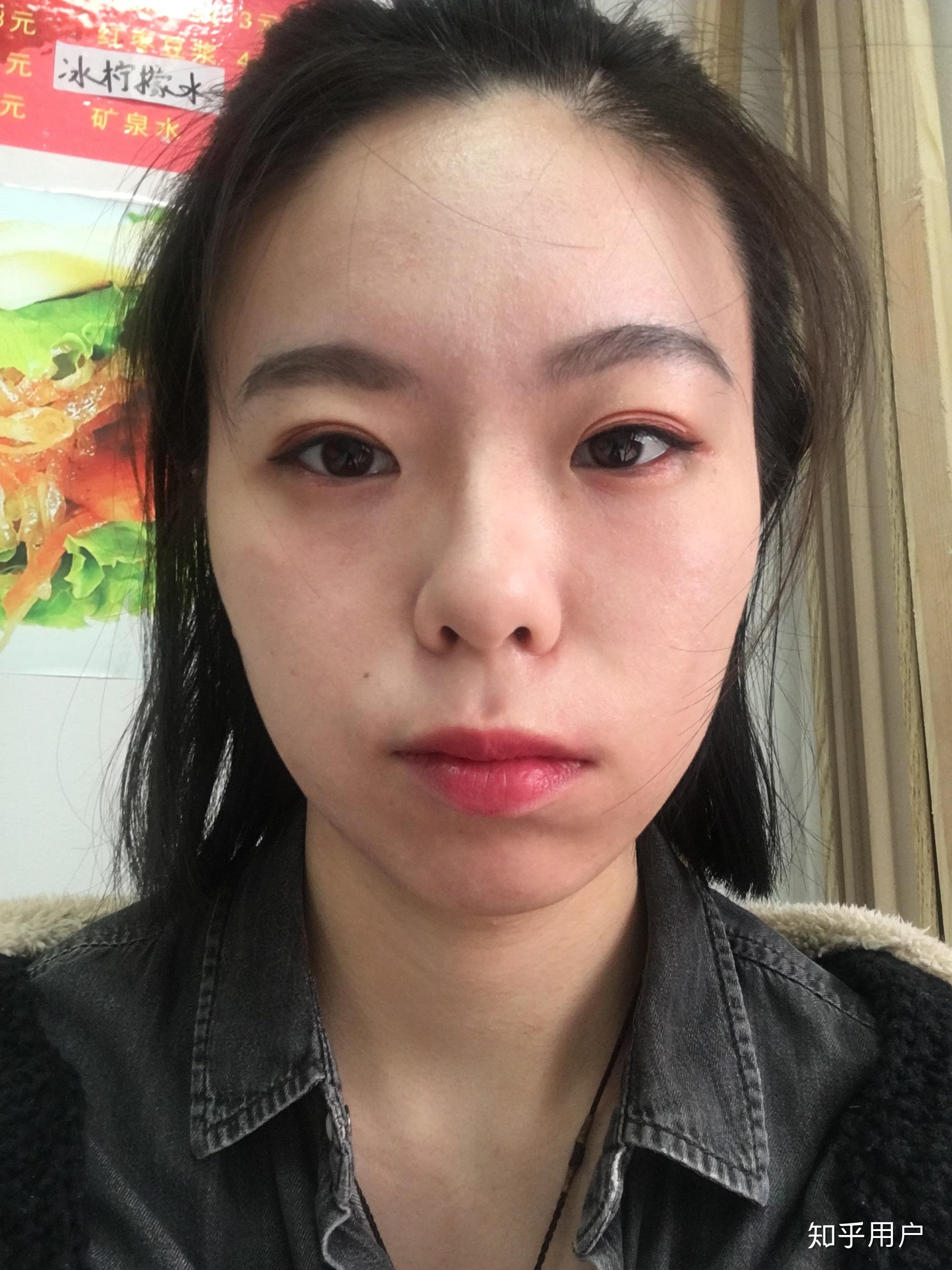 左右脸不对称 知乎