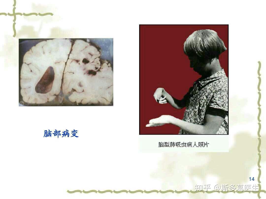 生吃淡水三文鱼到底有没有害