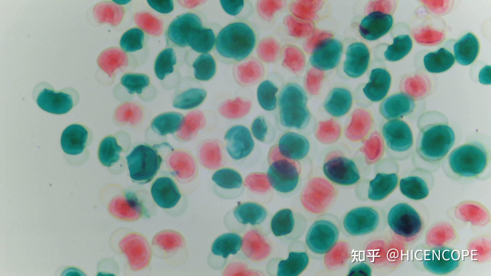 请问观察花粉细胞需要用到普通显微镜还是电子光学显微镜