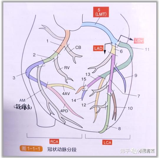 回旋支om图片