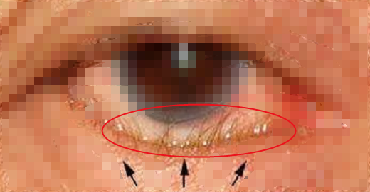 有没有长倒睫的朋友,给一点建议? - 知乎