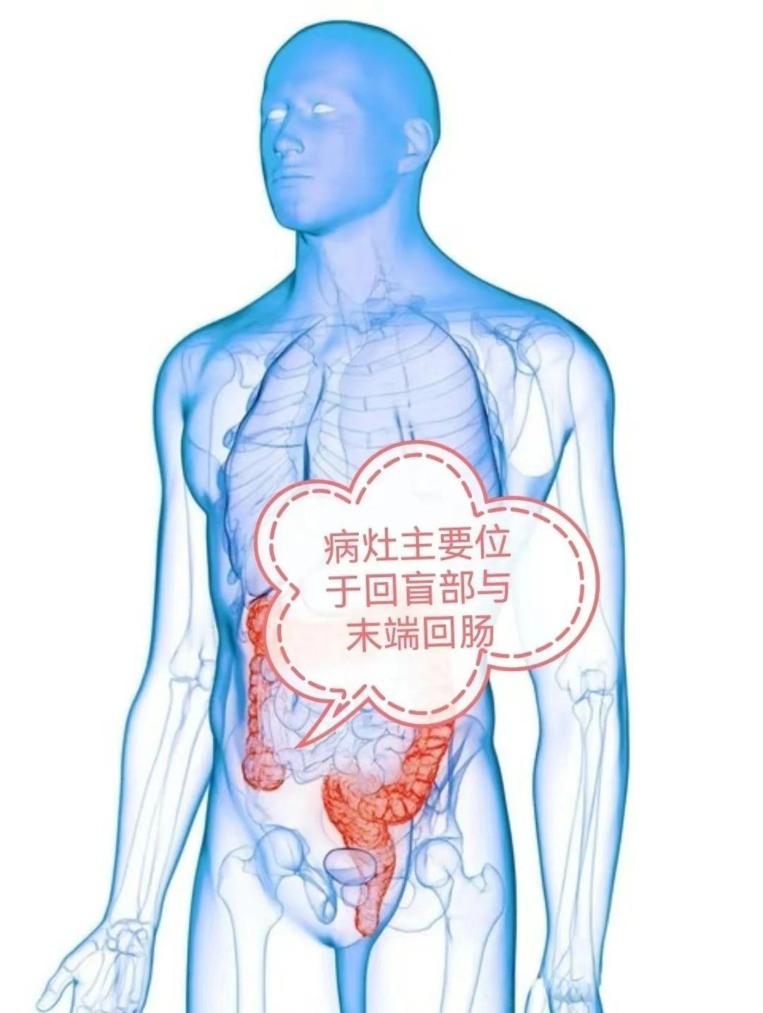 Nature Communications | 北京大学白凡研究组揭示结直肠癌近端淋巴结与远端器官的转移路径 - BIOPIC网站中文版