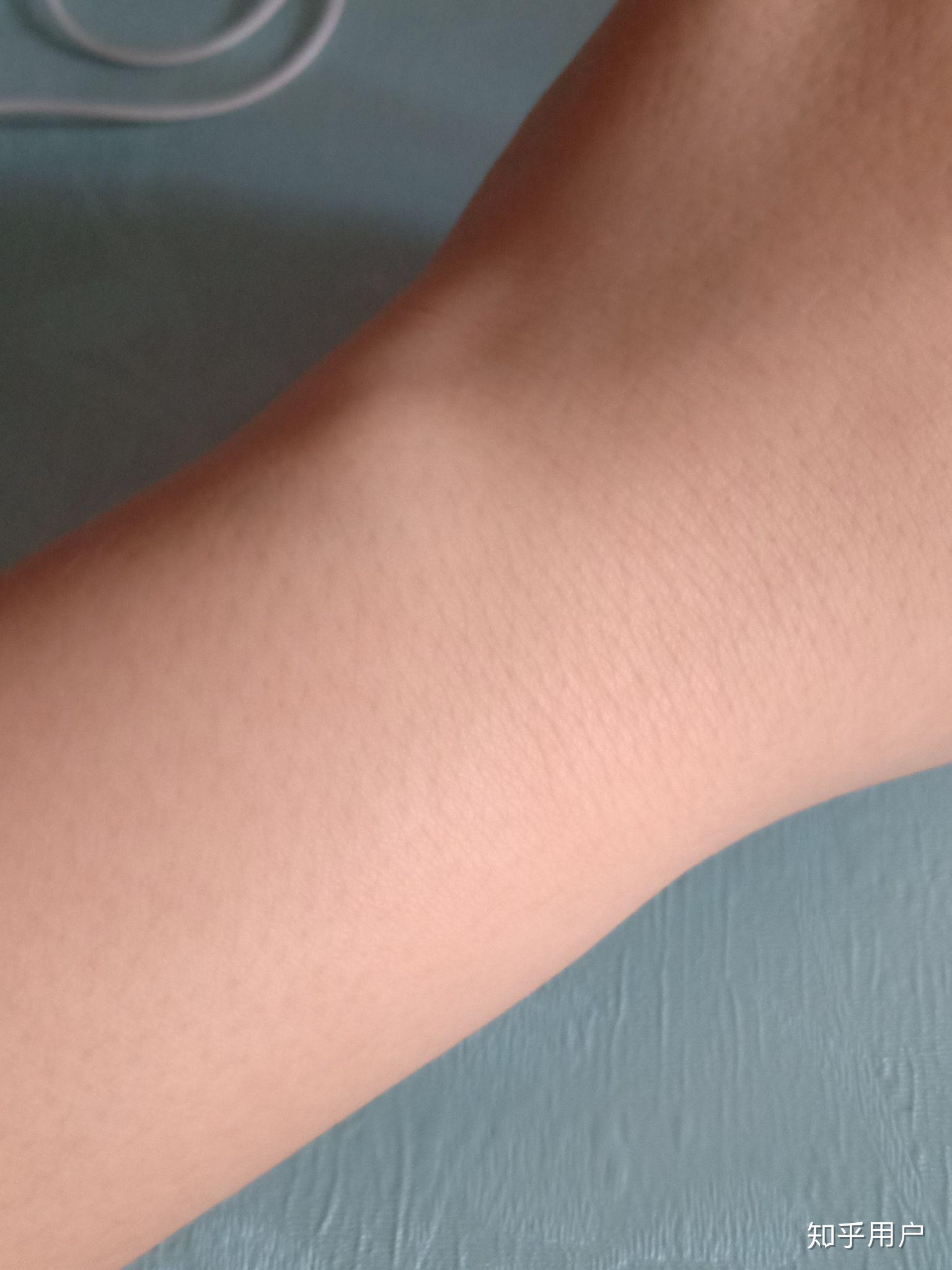 是手腕外侧靠近小指 而且左右手都有好久了按下去不痛. - 知乎