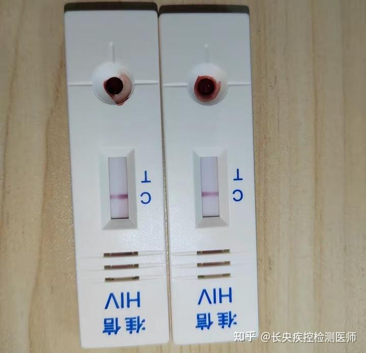 hiv试纸血量少会影响结果吗,看图? - 知乎