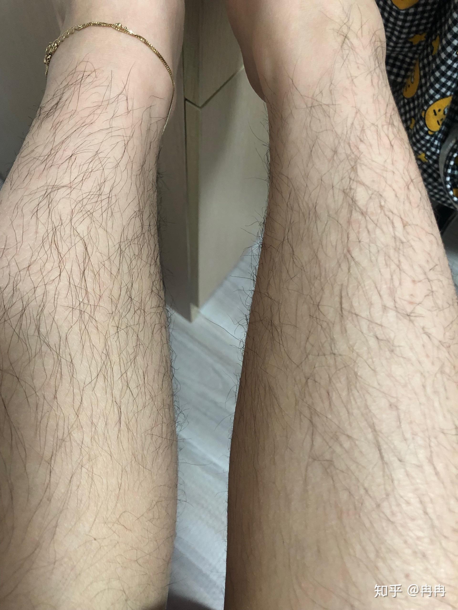 女生体毛多会有男生接受吗