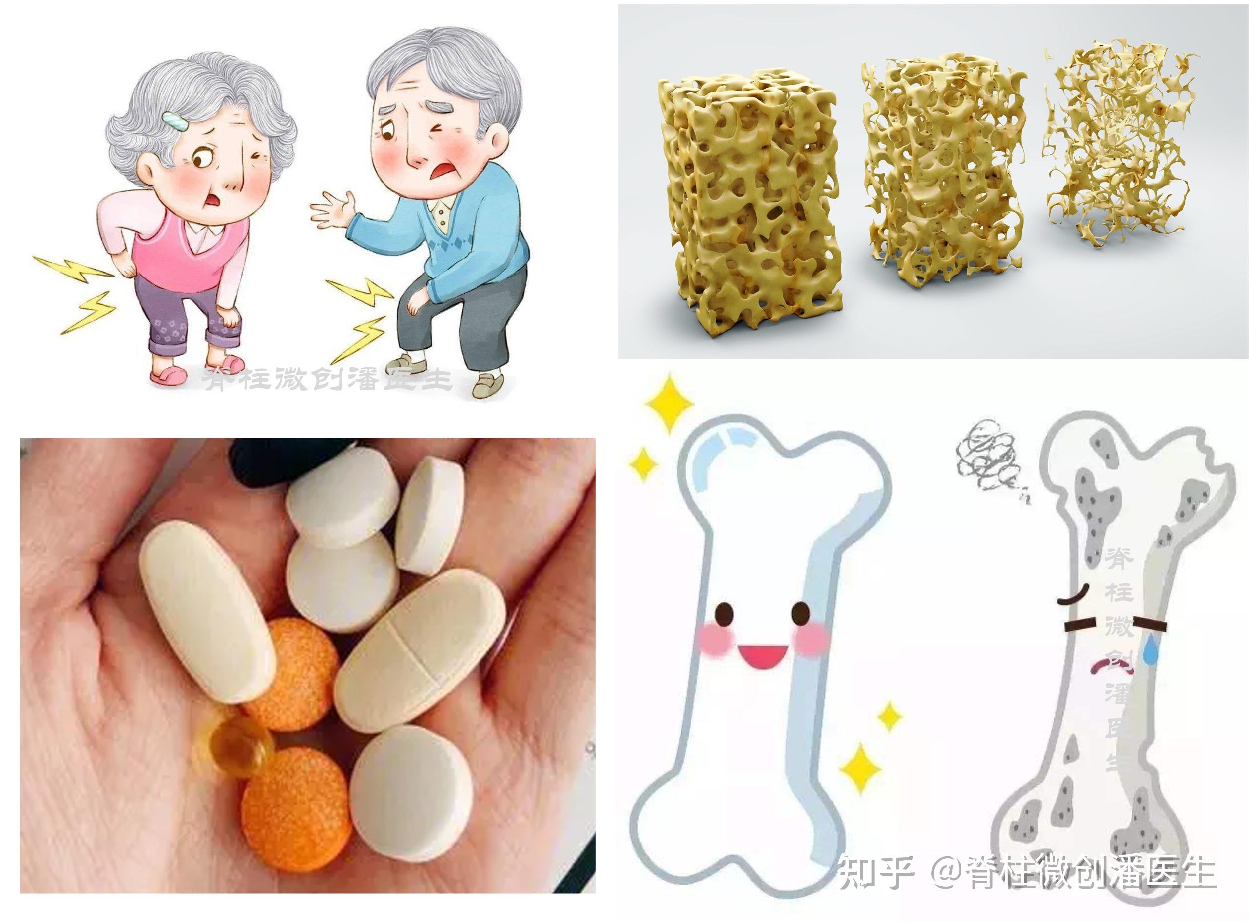 有没有适合中老年人吃的钙片?哪些钙剂是进口钙? - 知乎