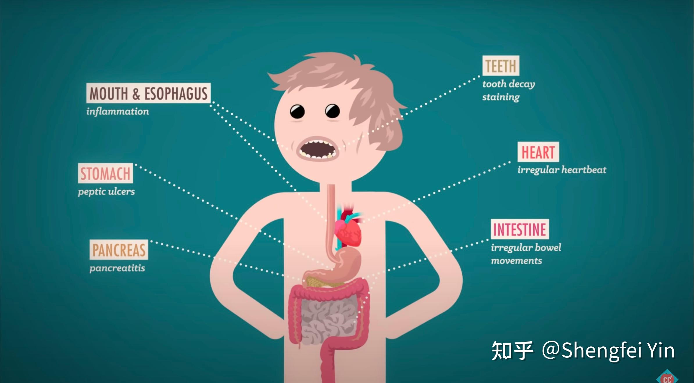 Eating & Body Dysmorphic Disorders - Crash Course Psychology #33 - 知乎
