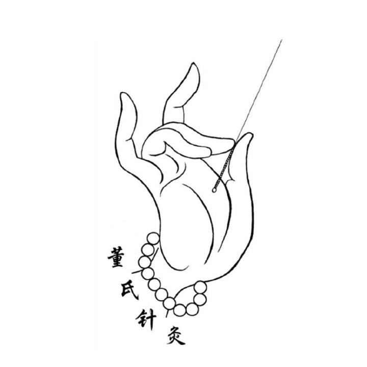 董氏奇穴针灸培训针灸刺血针灸里面的重武器