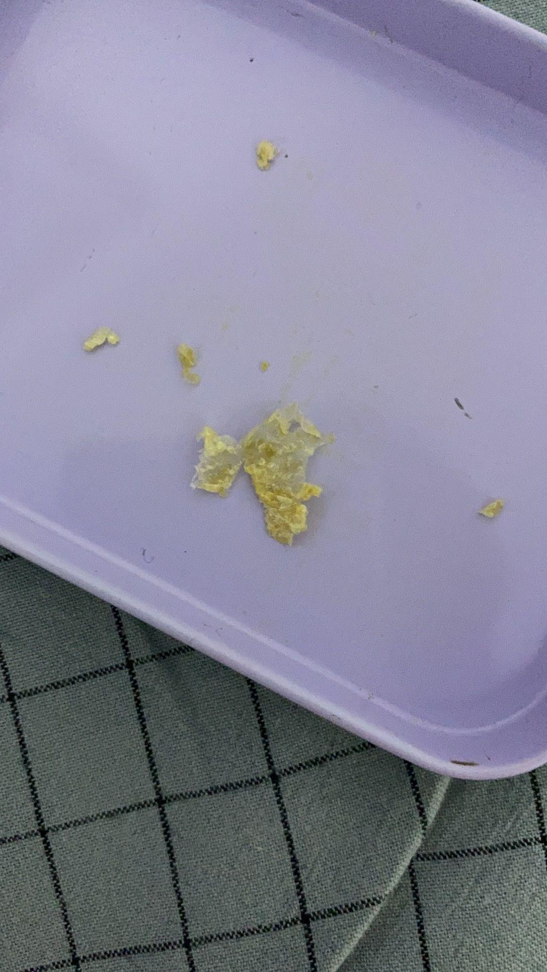 为什么我从来没掏出来过大号的耳耵聍