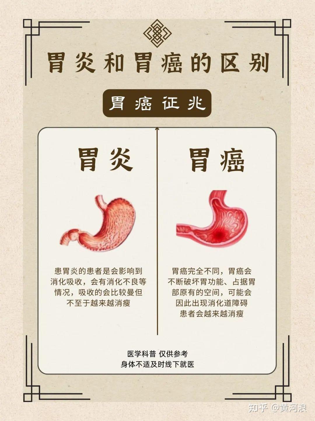 胃炎?胃癌?一分钟教你分辨出来! - 知乎