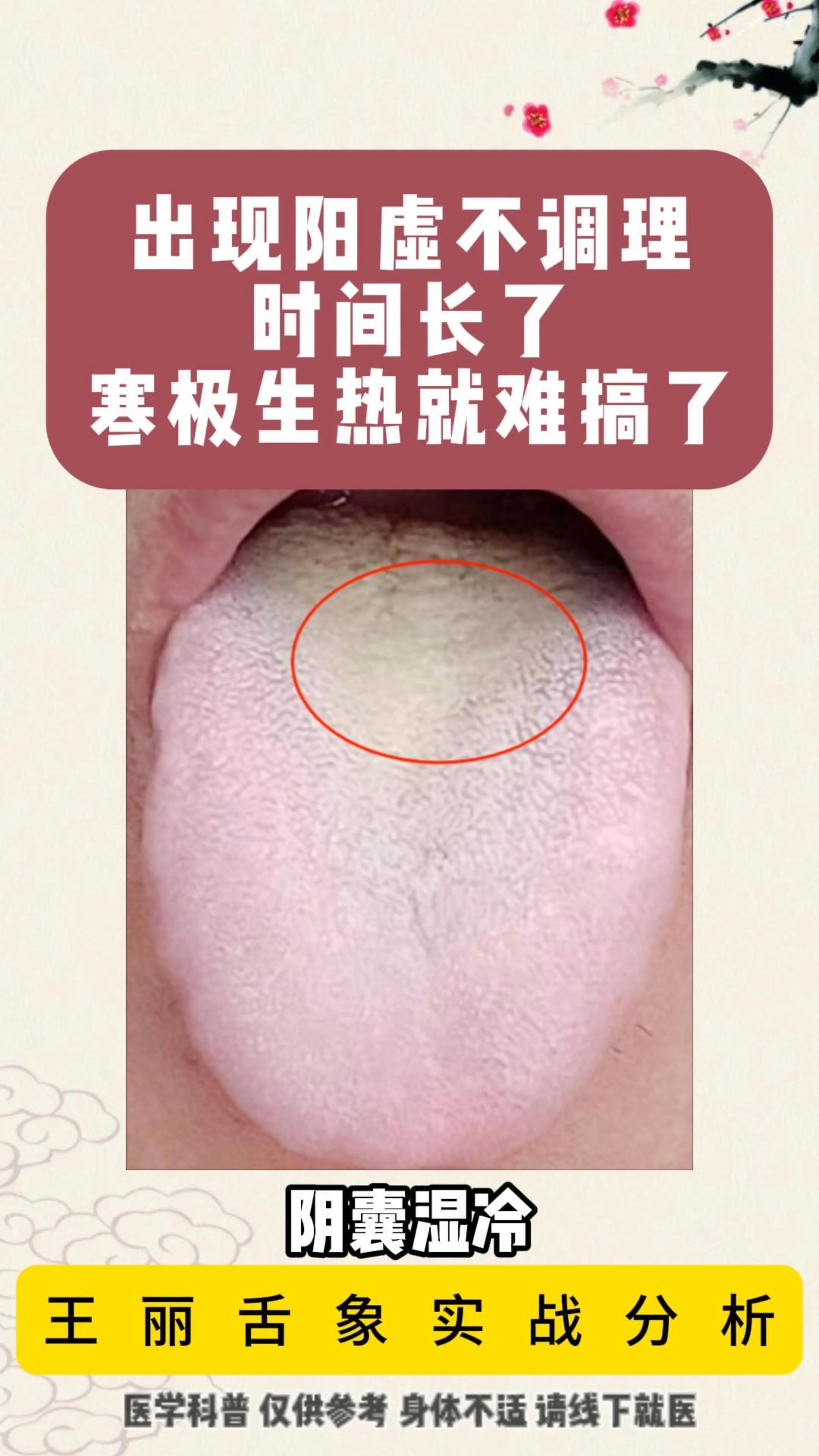 包含女性阴虚内热的表现的词条 包罗
女性阴虚内热的表现

的词条（包罗女性阴虚内热的表现的词条是什么） 女性