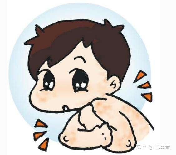 湿毒分四等级,看看你是不是该祛湿了! - 知乎
