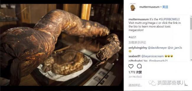 如何拉出一根50cm长的屎?