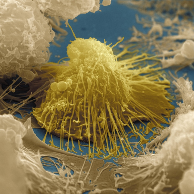 一分钟，带你了解“淋巴细胞” - 知乎