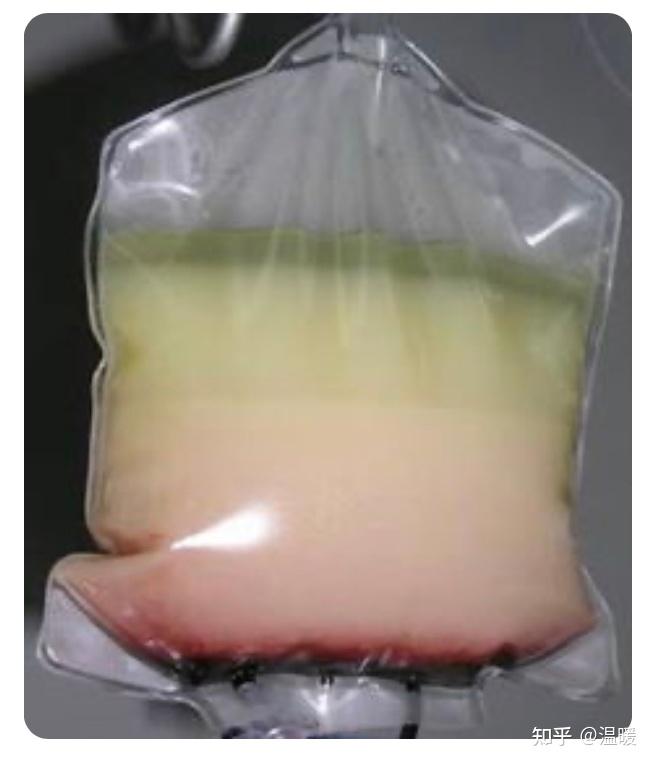 官方调查少年疑有偿献血浆16次死亡涉事企业曾公开宣传拉人头给200元