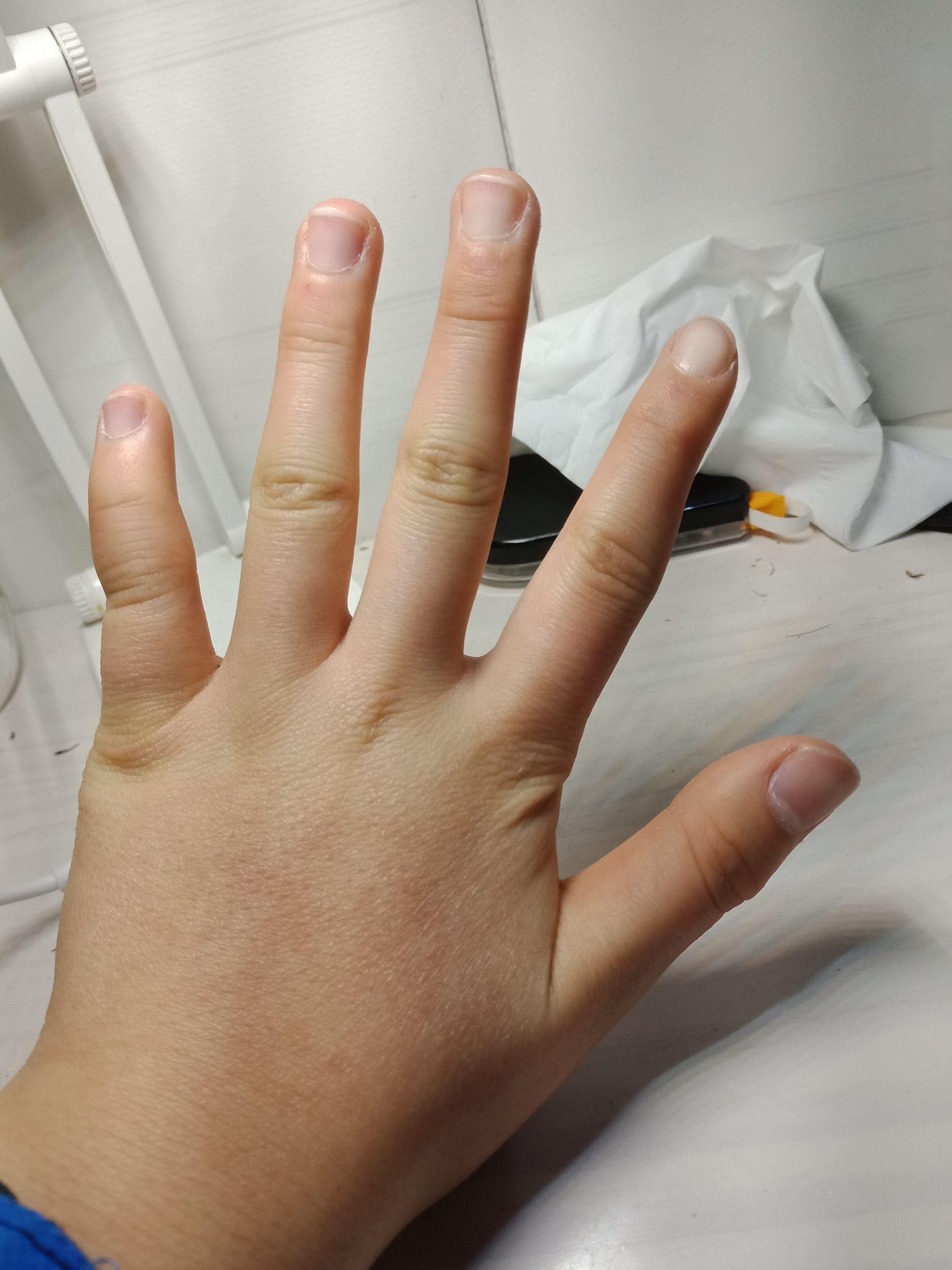 手小或者手胖或者手丑是一种什么体验