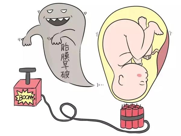 孕28周后出现这几种症状时需警惕胎膜早破
