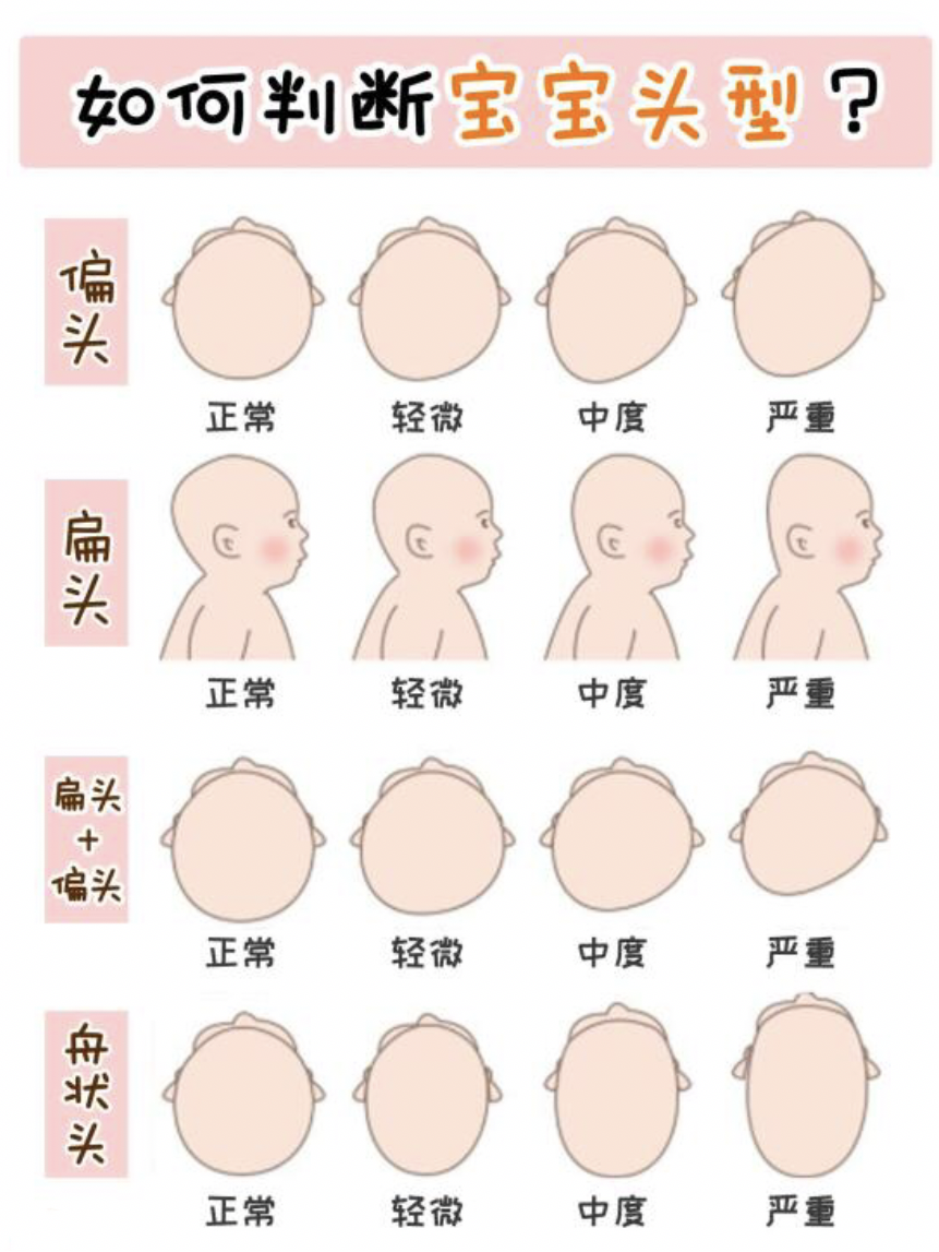 月嫂一直让宝宝两边来回侧睡,宝宝后脑勺比较凸,月嫂说长长就好了,是