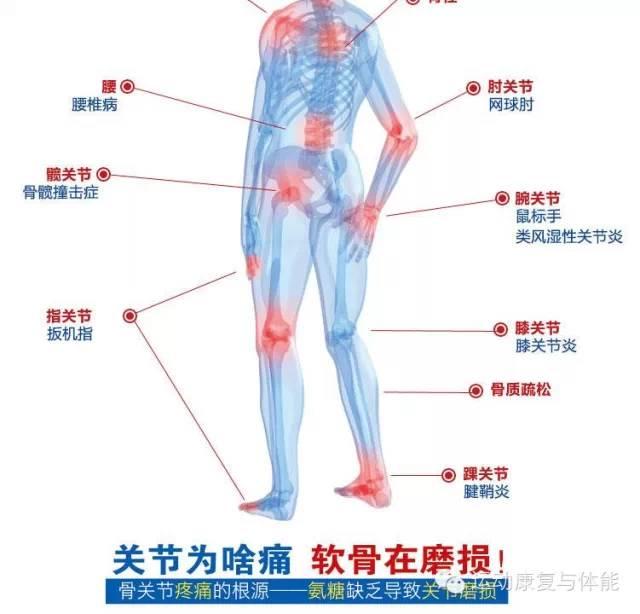 膝盖疼痛可以吃软骨素吗