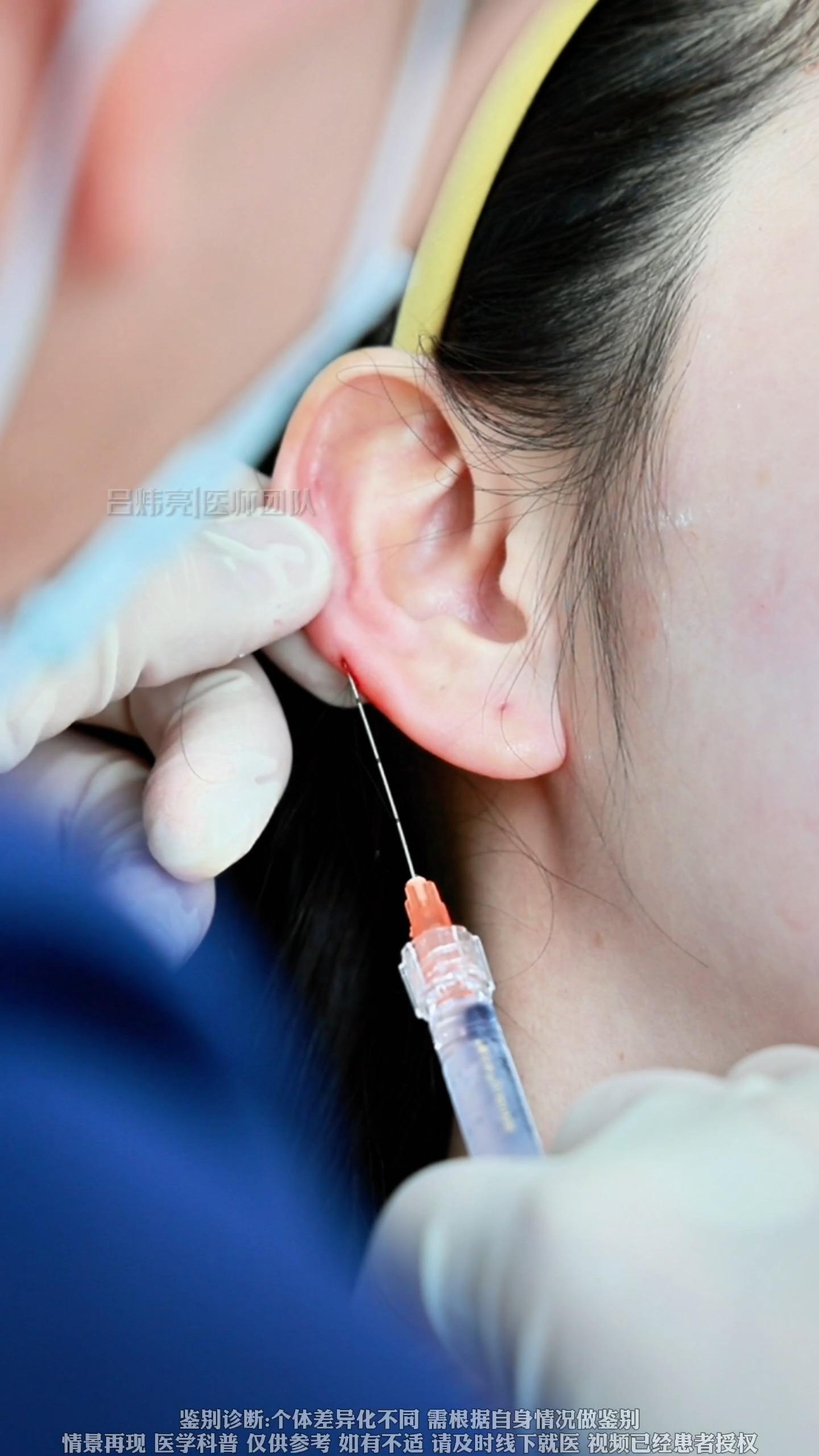 如何打造精灵耳