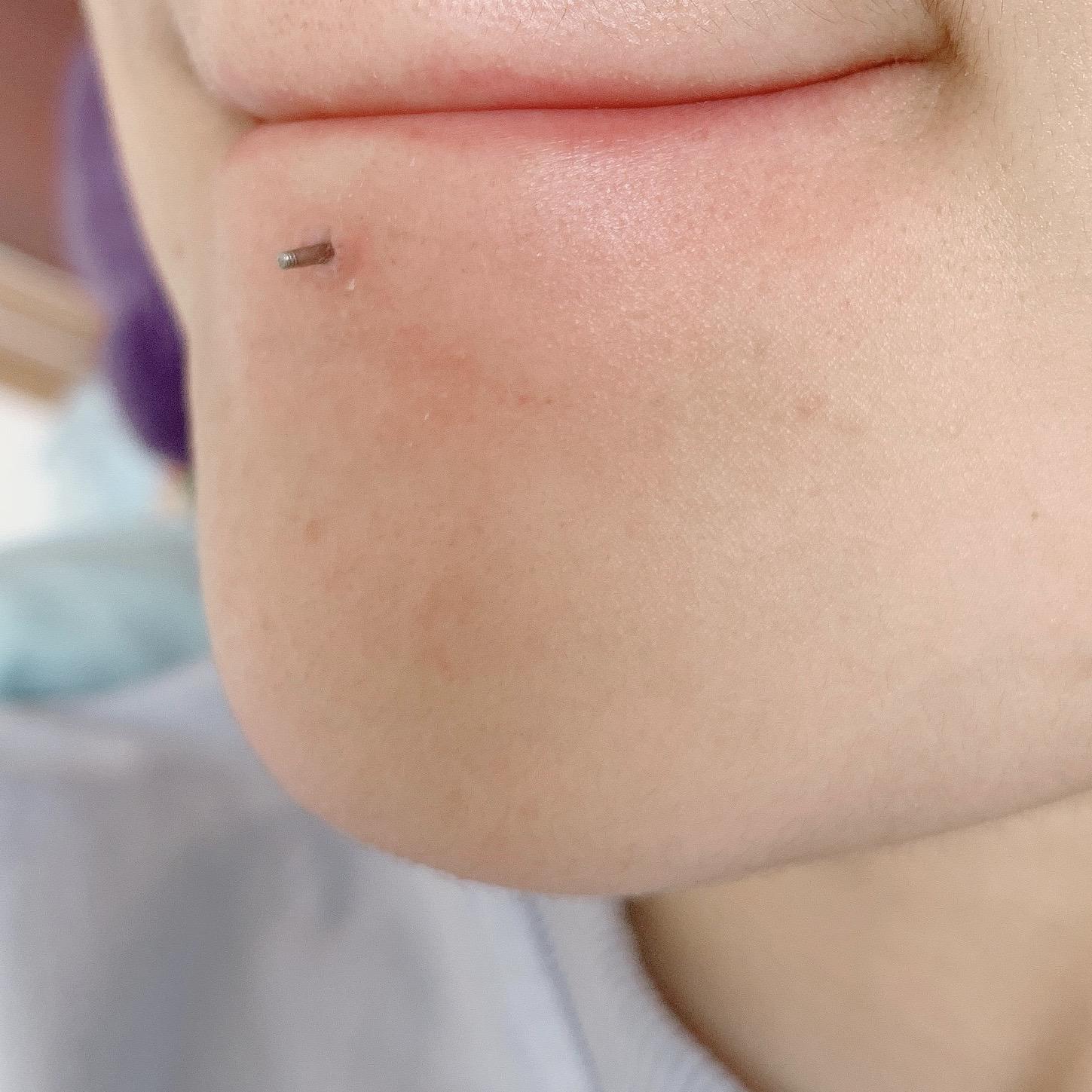 我想看看唇钉摘下后是什么样子的