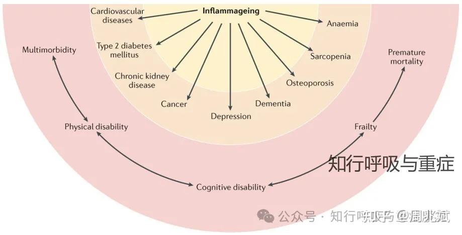 第201期 衰弱的概念、病理机制与评估策略 - 知乎