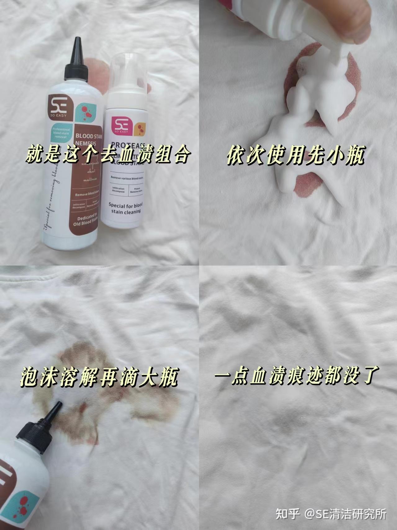 衣服上的血渍怎么洗掉? - 知乎