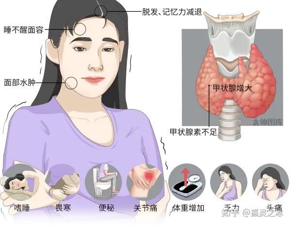 甲减对身体有哪些危害？又该如何自我判断？ - 知乎