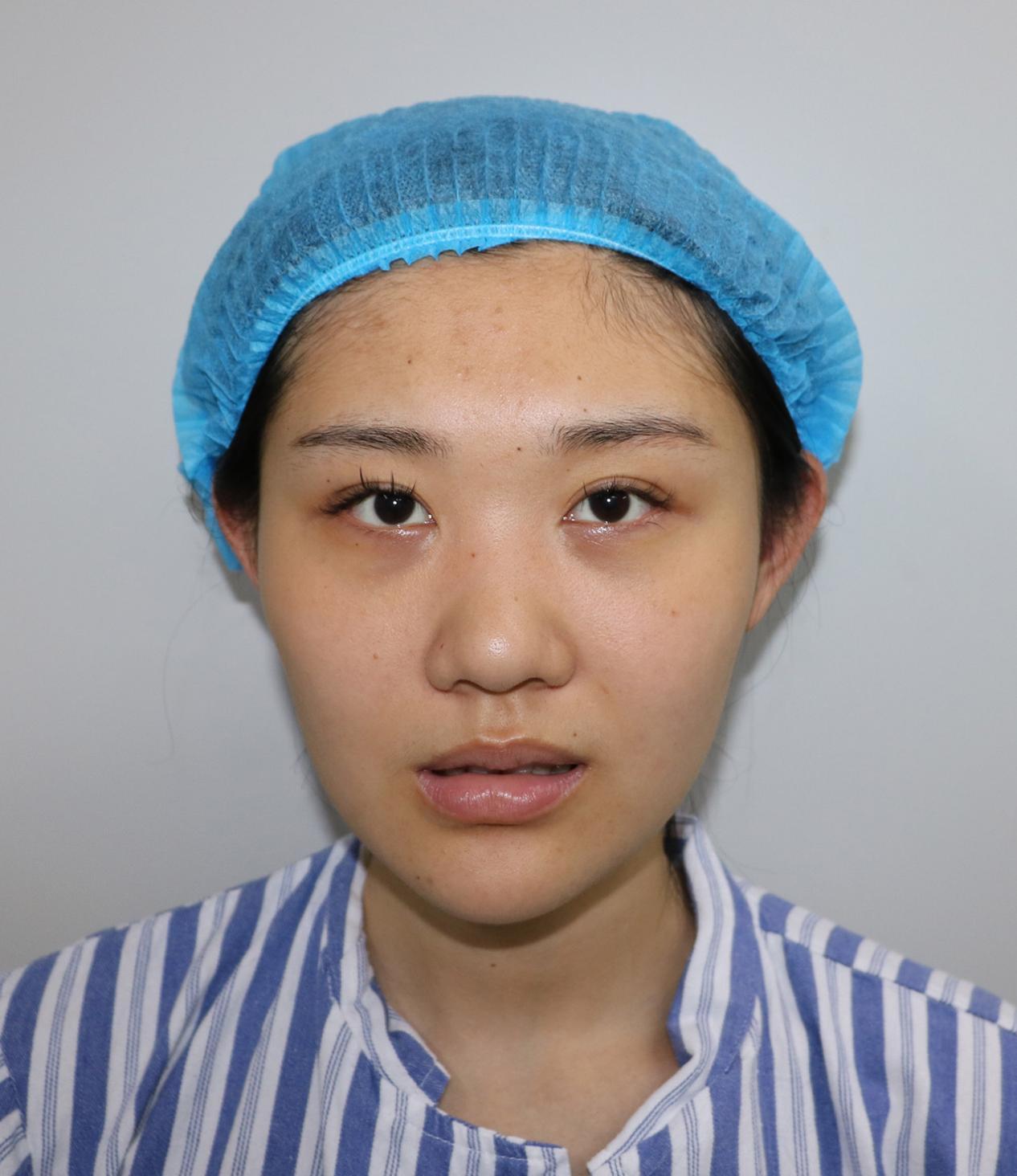 北京京民王志坚做鼻子怎么样?贵不贵?