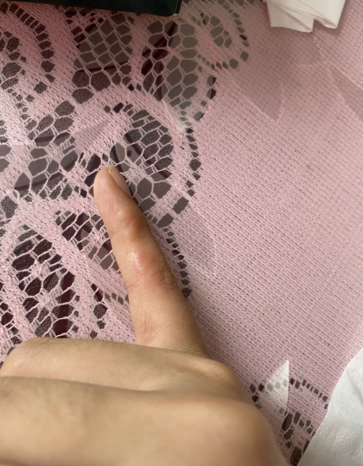 环状肉芽肿是由于压力引起的吗? - 知乎