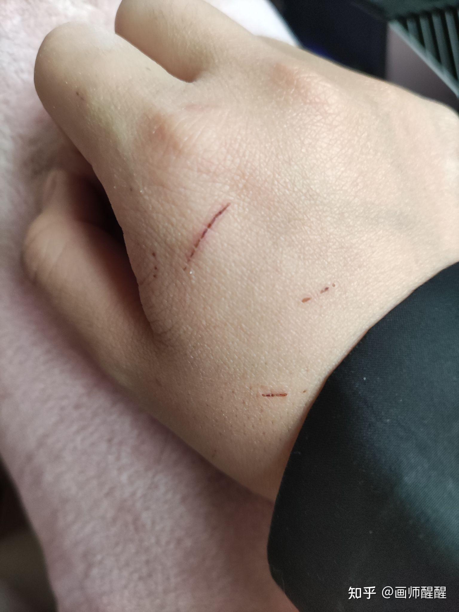 今天被自家养的兔子抓伤了,需要打狂犬疫苗吗? - 知乎