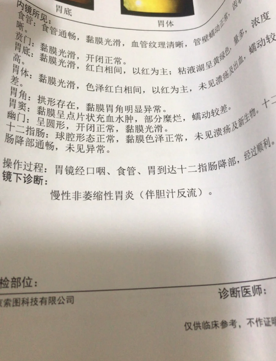 说一下我自己的胆汁反流胃炎的经历吧这1年中真的
