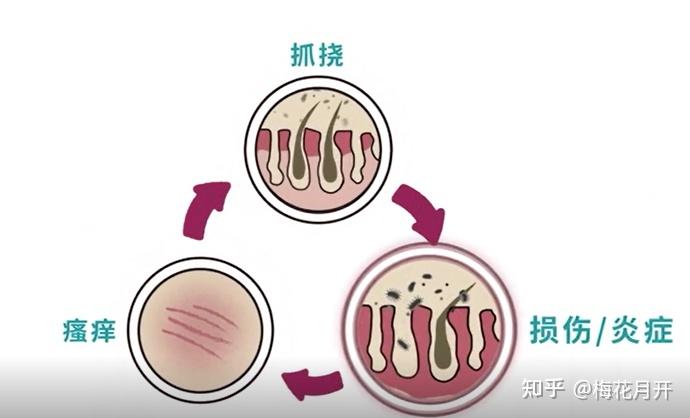 狗狗皮膚病的蟎蟲真菌感染怎麼治療麻煩嗎