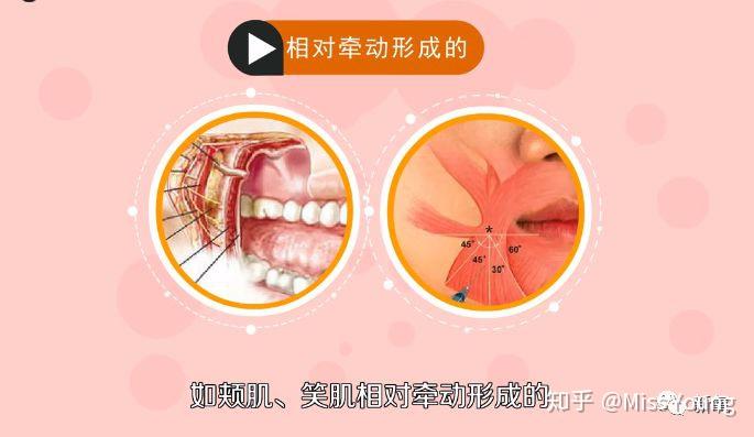 酒窝可以后天形成吗? - 知乎