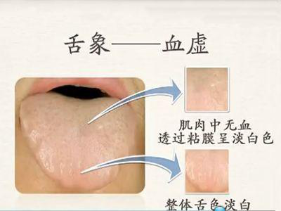 血虚头昏,补血总是不管用?送你一剂中成药 气血双补 养心安神 - 知乎