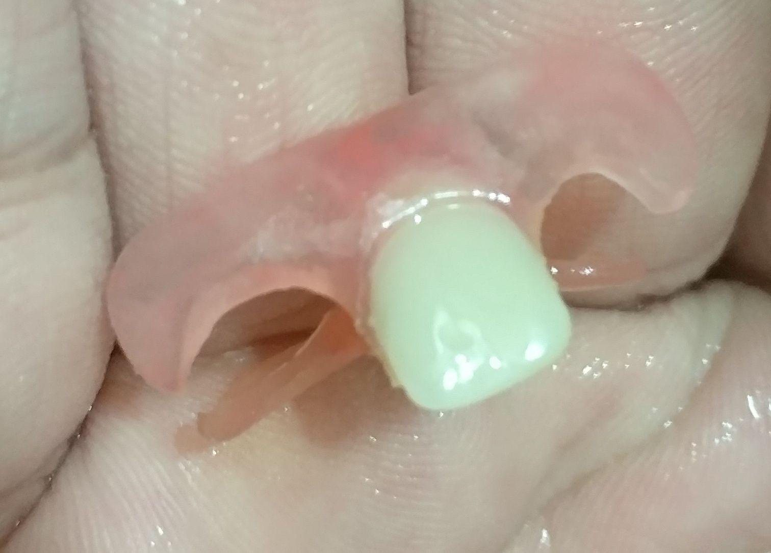 戴活动义齿是什么体验? - 知乎