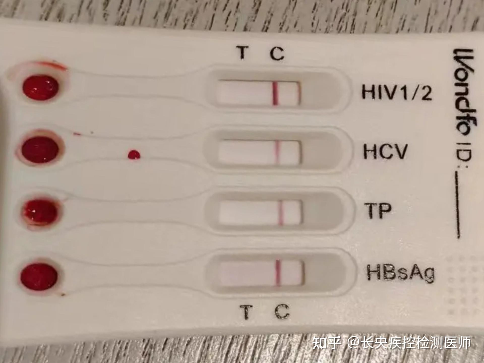 请问万孚四合一试纸测hiv准吗?