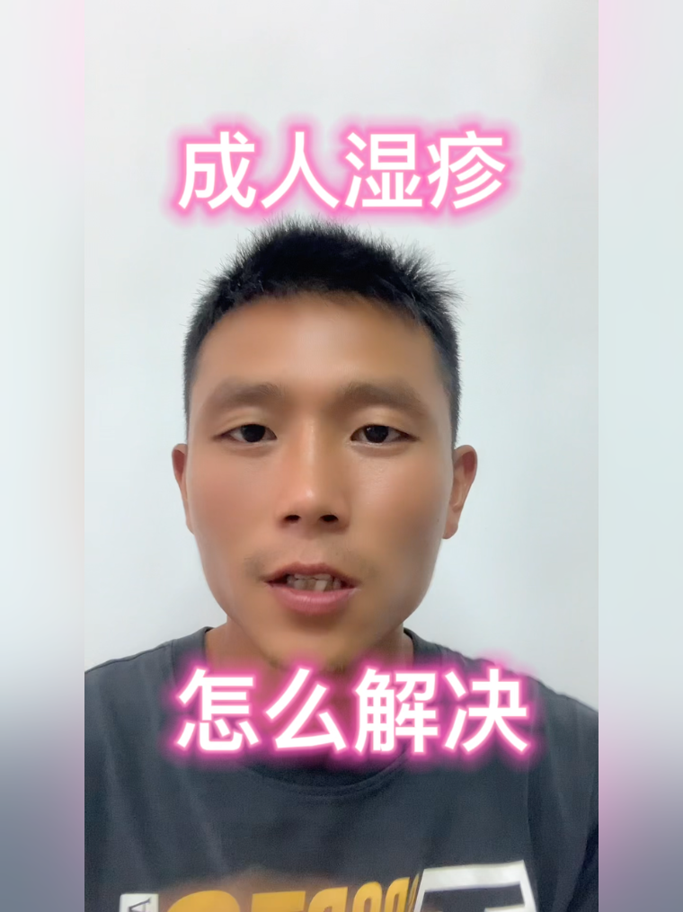 成人湿疹怎么办赶快看过来
