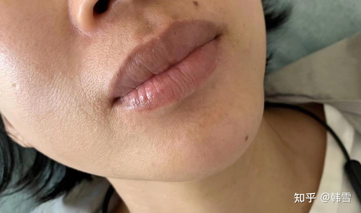 嘴唇变乌? - 知乎