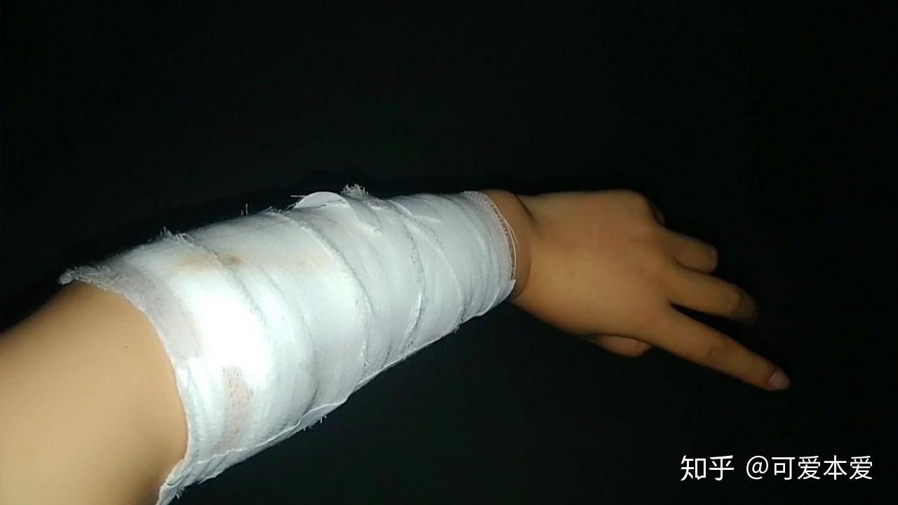 忧郁症自残是什么感觉