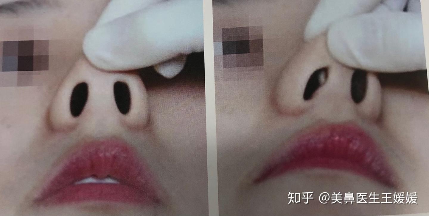 面诊到底有什么秘密呢? - 知乎