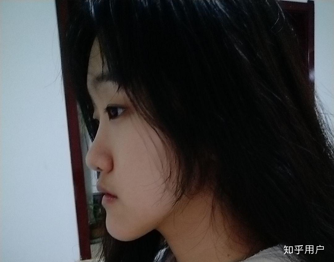 下巴前突但并不是地包天很自卑怎么办