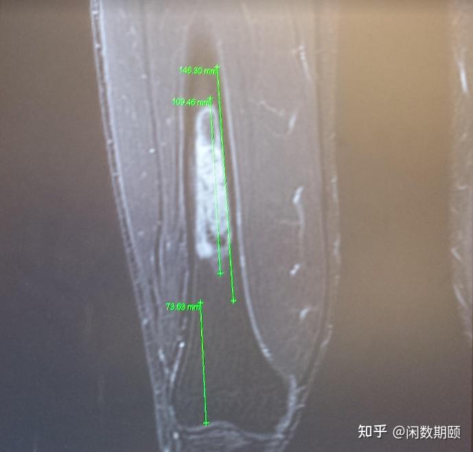 身边是否有985毕业却混得很惨的例子？