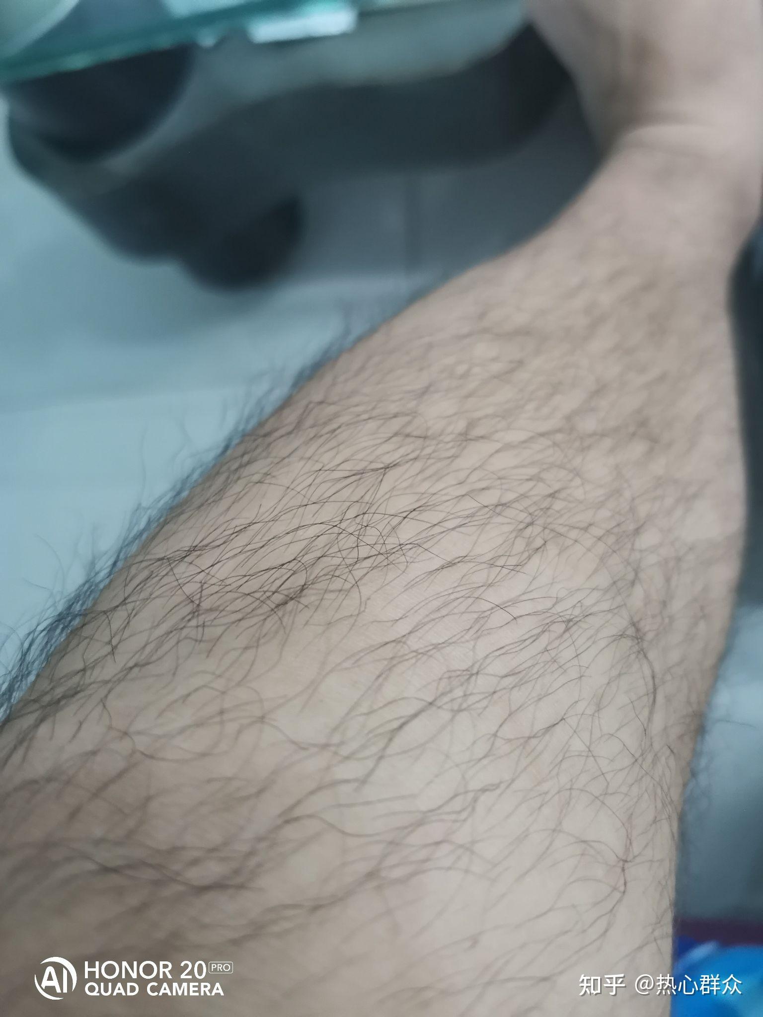 体毛旺盛是种怎样的体验? - 知乎