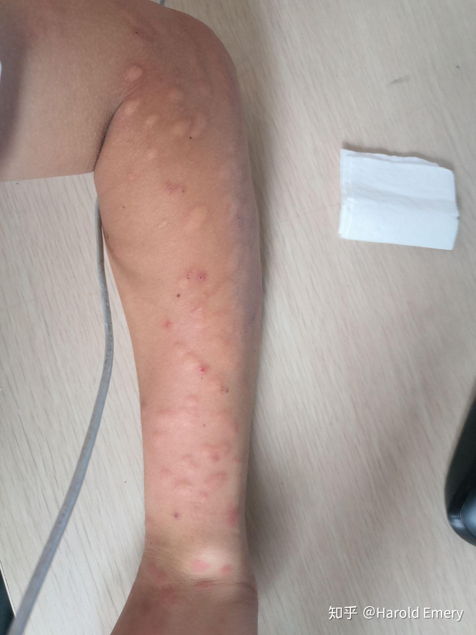 四川很小的一种蚊子蠛蚊是什么东西