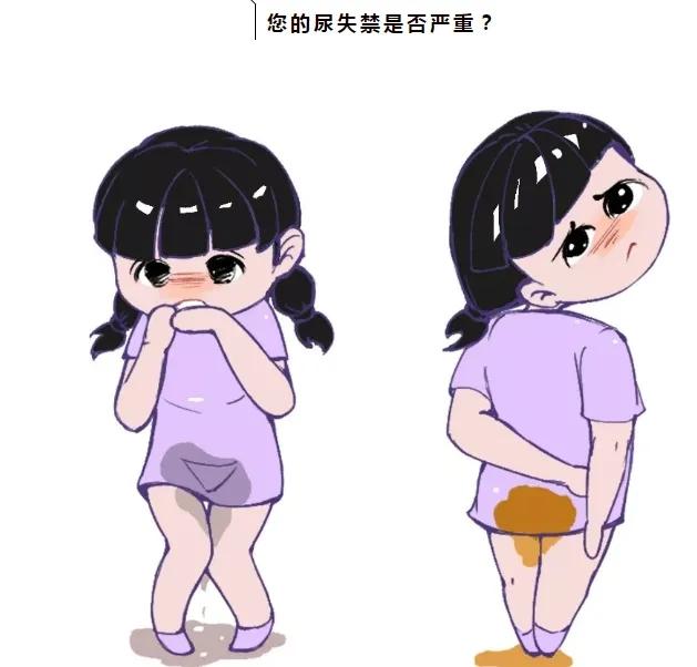 咳嗽尿裤子与膀胱脱垂同时存在,一次手术治疗两种疾病