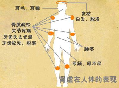 如何区分肾阳虚和肾阴虚哪种肾虚可以服用六味地黄丸