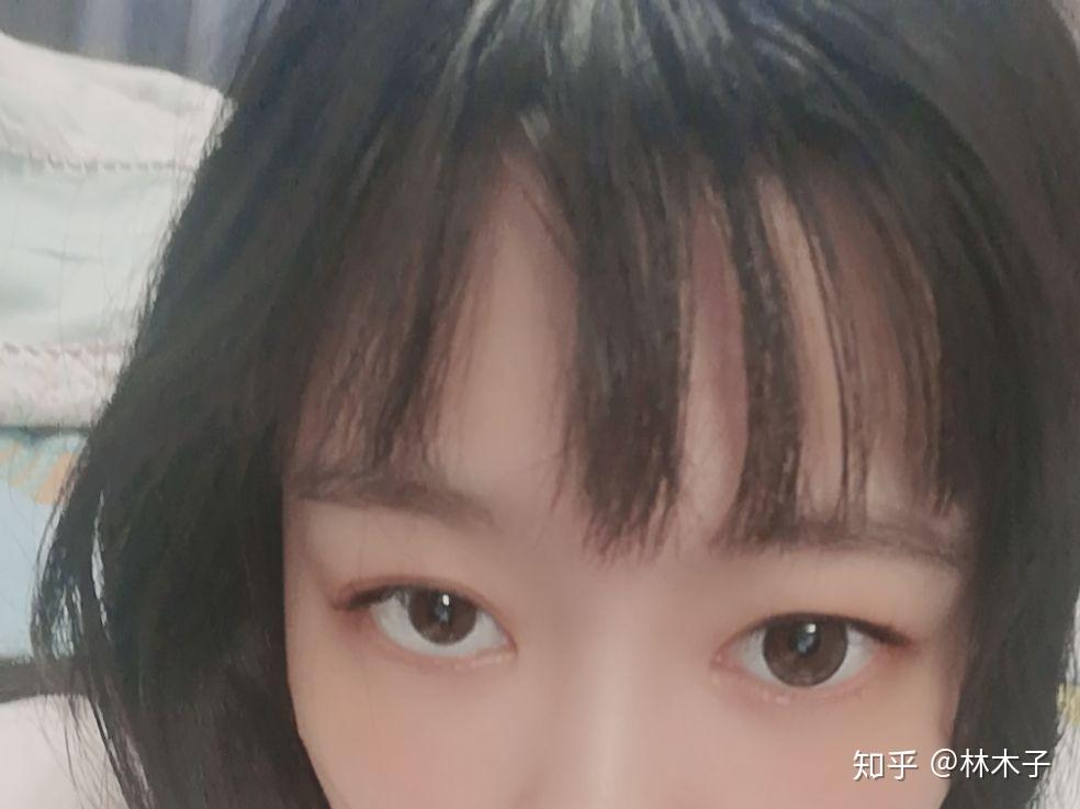 瞳孔很小,眼眶却很大,戴不戴美瞳区别很大,即将订婚了怕未来老公看到